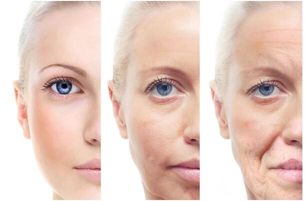 حذف لیزر تغییرات مربوط به سن