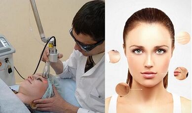 جوانسازی پوست با لیزر چگونه انجام می شود؟